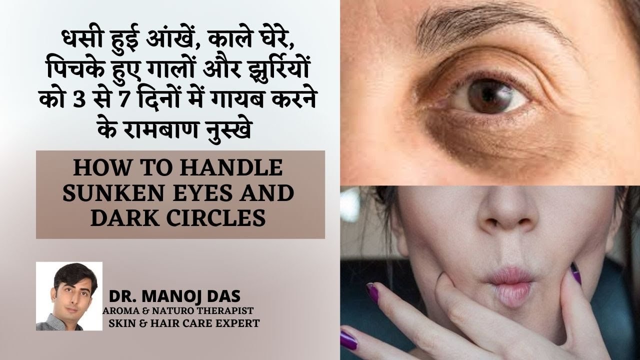 धसी हुई आंखें, काले घेरे, पिचके हुए गालों और झुर्रियों गायब करने के रामबाण नुस्खे I DR. MANOJ DAS