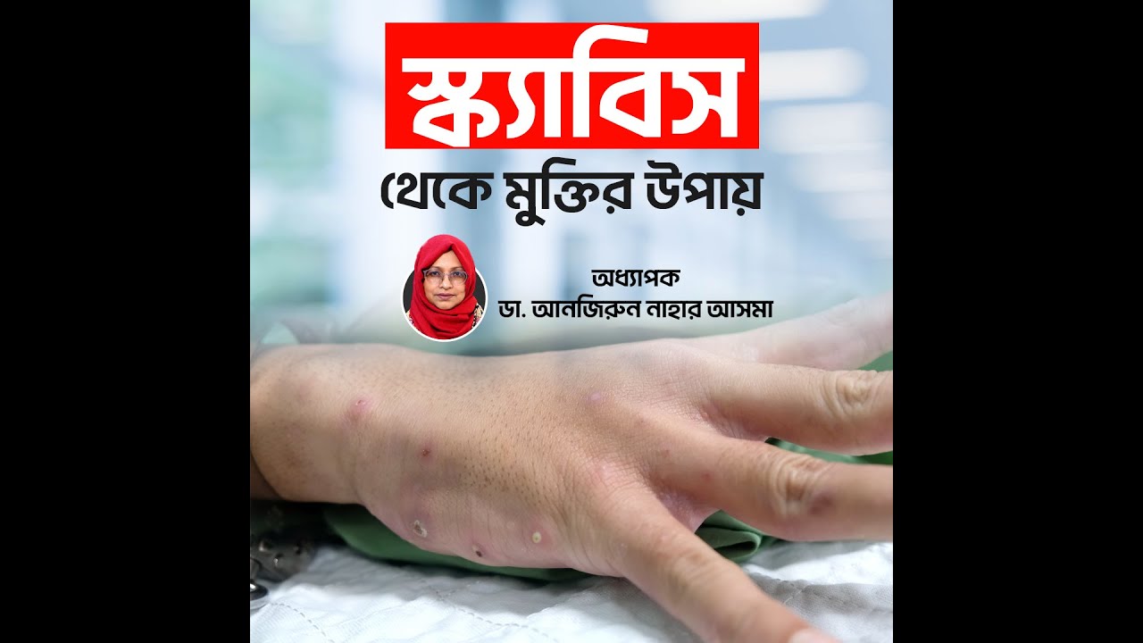 স্ক্যাবিস কেন হয় ও কীভাবে সারে? | Complete Scabies Treatment Guide