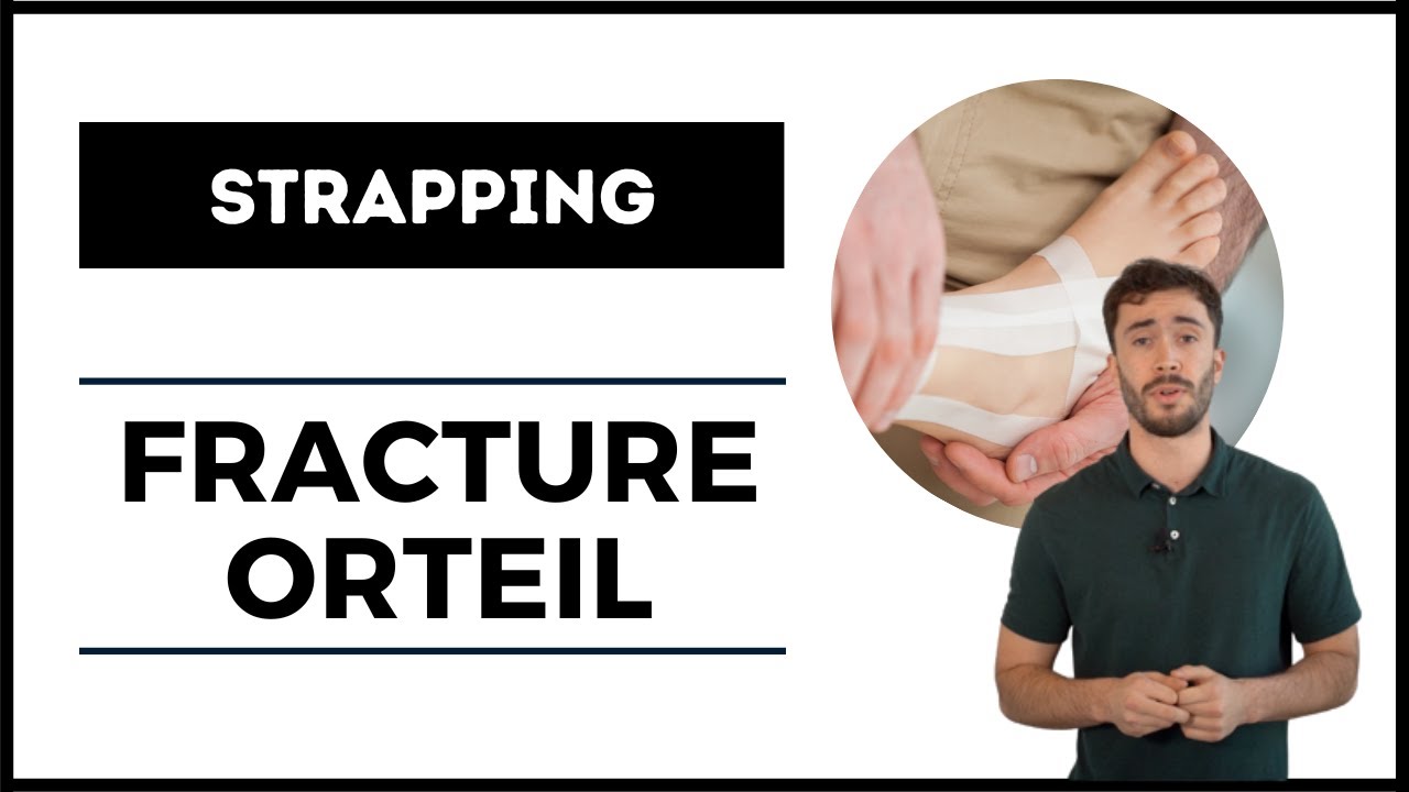 STRAPPING POUR FRACTURE D'UN ORTEIL
