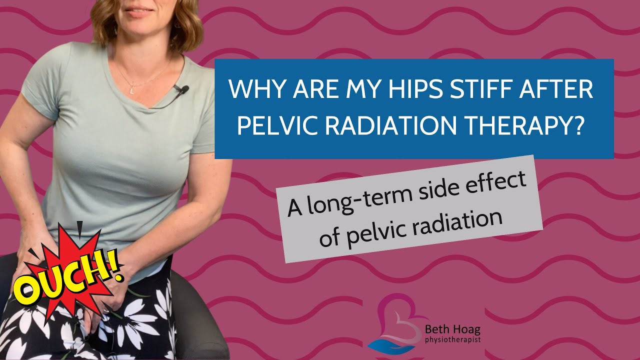 Pelvic Radiation Therapy Side Effects: Stiff & Painful Hips and Low Back