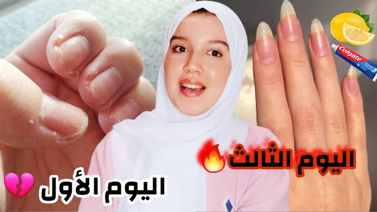 كيفاش كنطول ضفاري ف 3 أيام فقط⚡و بمكونات  فالمنزل | 3 وصفات غيصدموك🔥