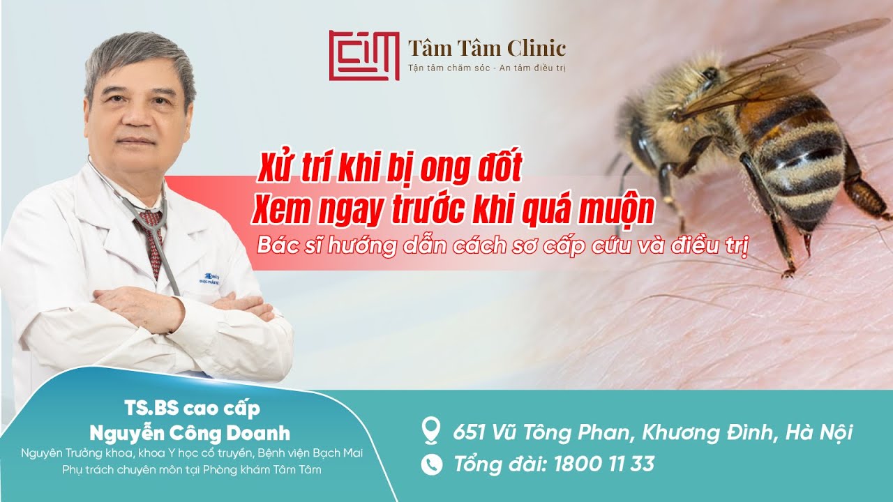 Ong đốt có thể nguy hiểm nếu xử lý sai - Bác sĩ chia sẻ cách sơ cấp cứu ong đốt an toàn