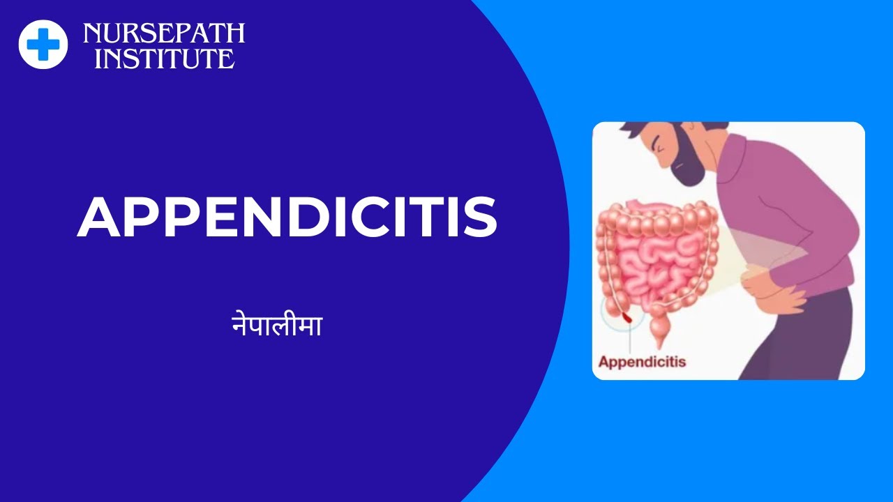 Appendicitis Explained Easily | For MEDICAL students | Definition, Anatomy, Physiology, Management