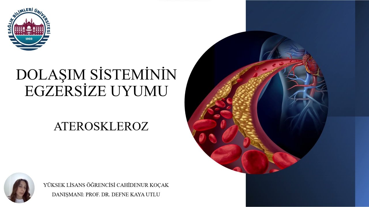Cahidenur Koçak Anlatıyor: Egzersize Dolaşım Sisteminin Uyumu: Aterosklerozda Egzersiz