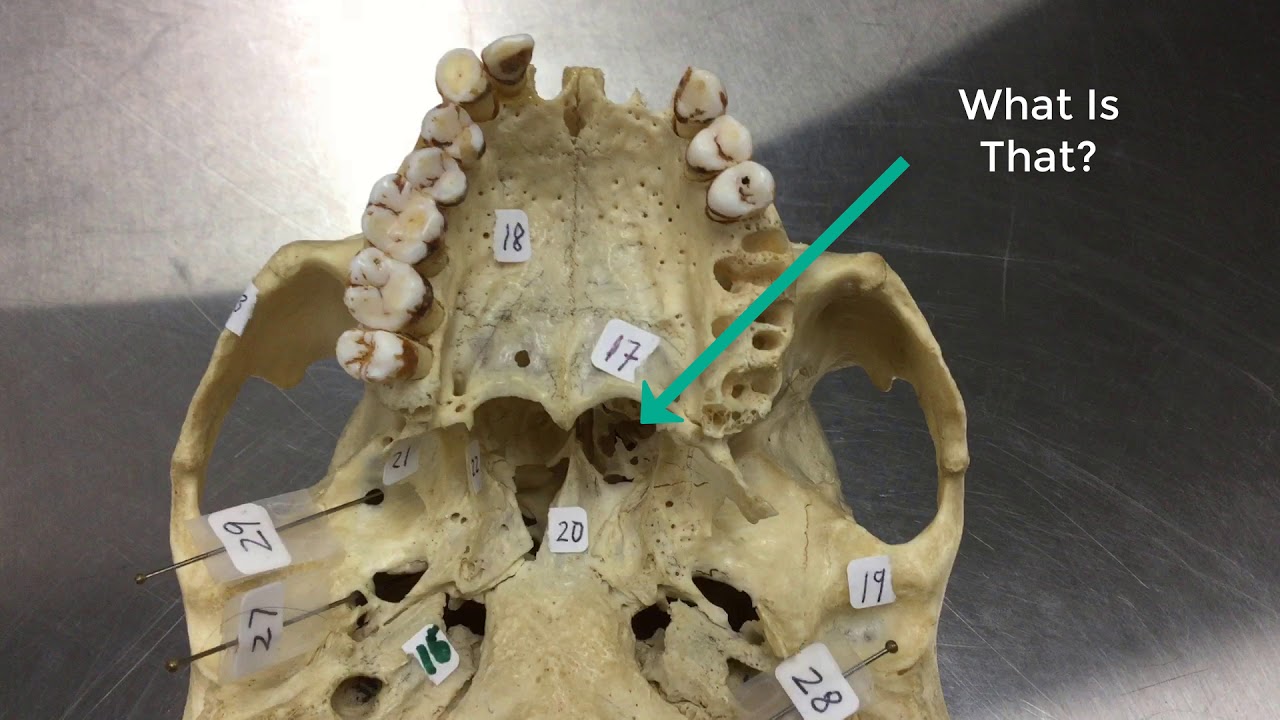 Skull Osteology: Quick Quiz #3 (Winter-2019)