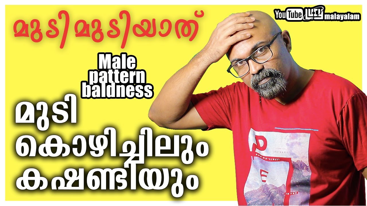 Male pattern baldness Malayalam | Hair loss malayalam | Lucy Malayalam | Chandrasekhar. R