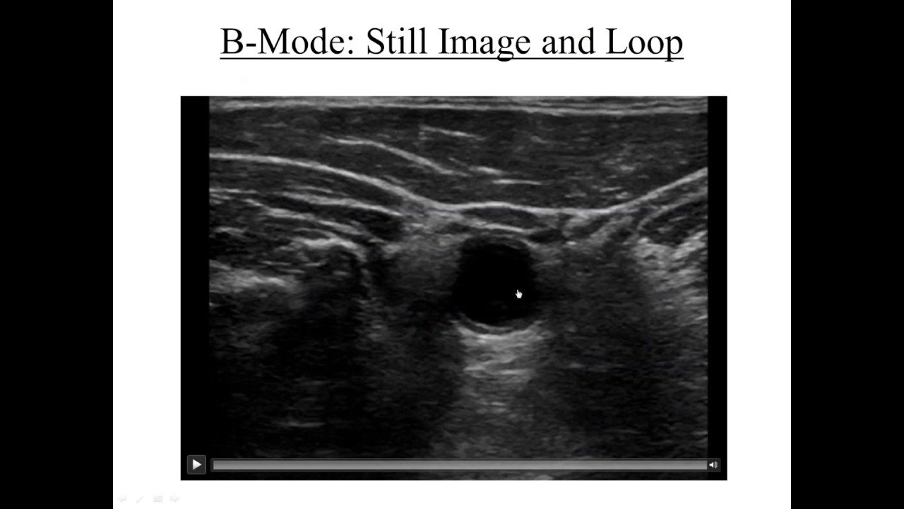 AIUM/ACP/SUSME Webinar: Primary Care Office-Based Ultrasound
