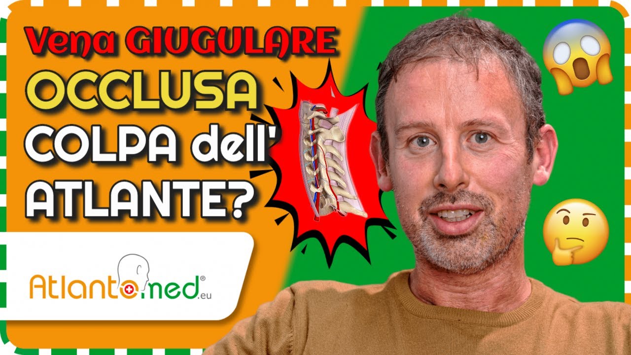 SCLEROSI MULTIPLA, PARESTESIE e FORMICOLIO: il ruolo della VENA GIUGULARE e della VERTEBRA ATLANTE❗️