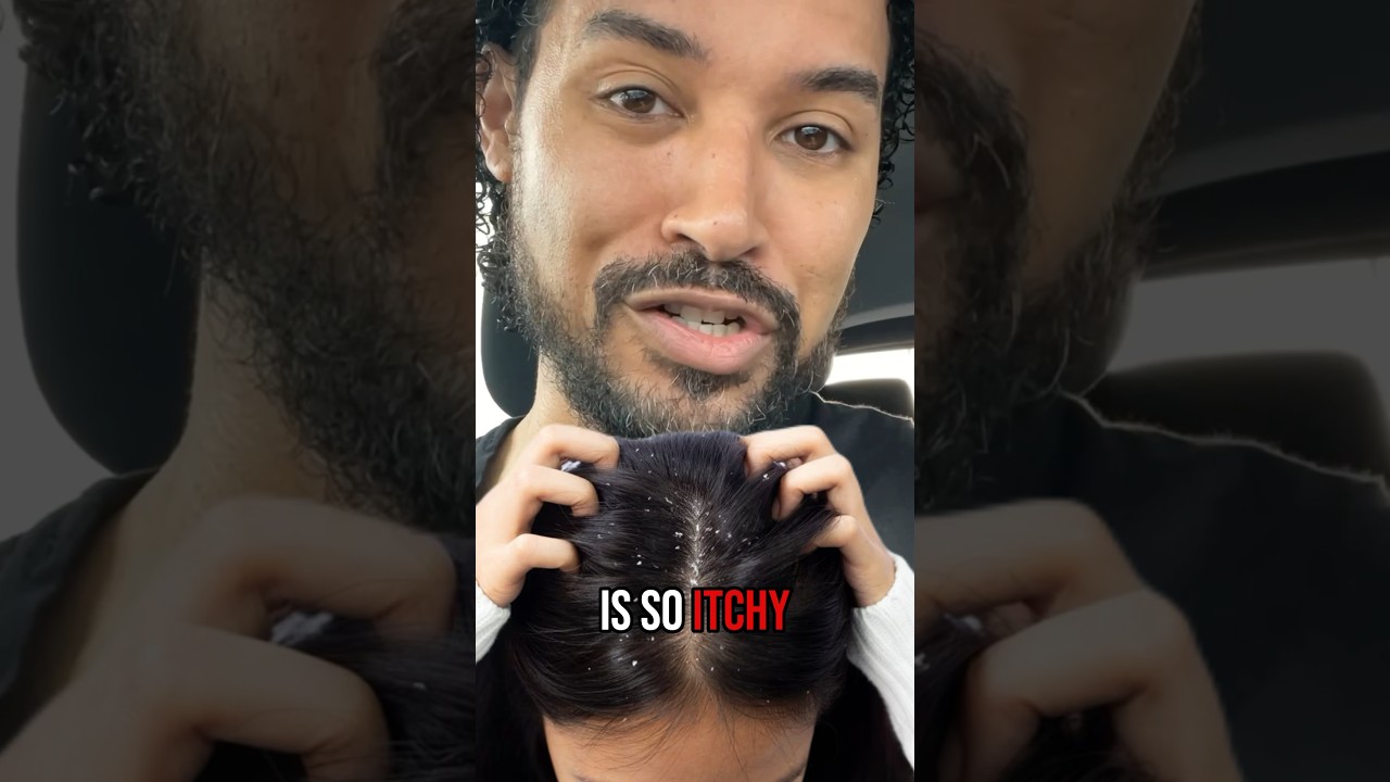 🤯 Why your scalp is so ITCHY
