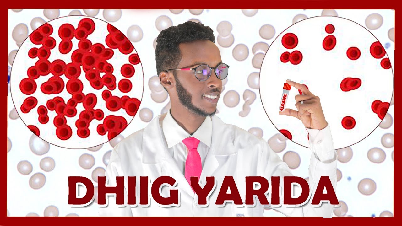 DHIIG YARIDA IYO SIDA LOO DAAWEEYO | Anemia