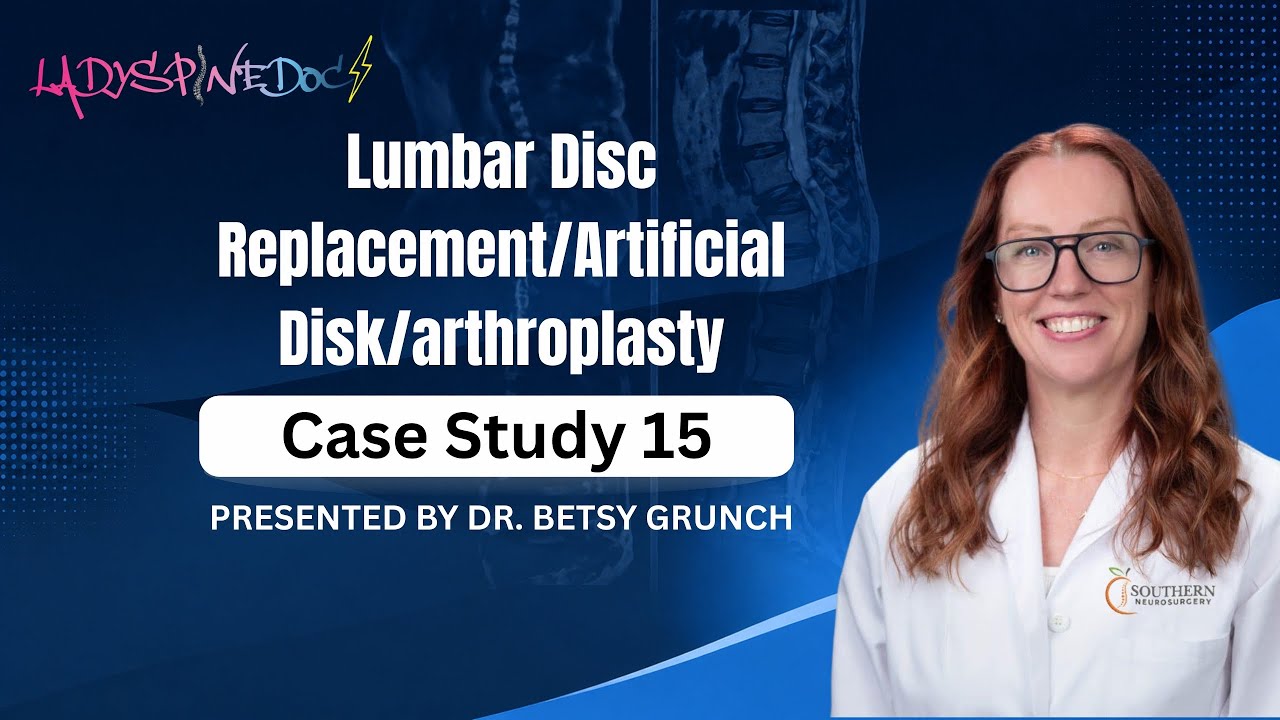 Case study 15 - Lumbar Disc Replacement/Artificial Disk/arthroplasty  - explained by a neurosurgeon.