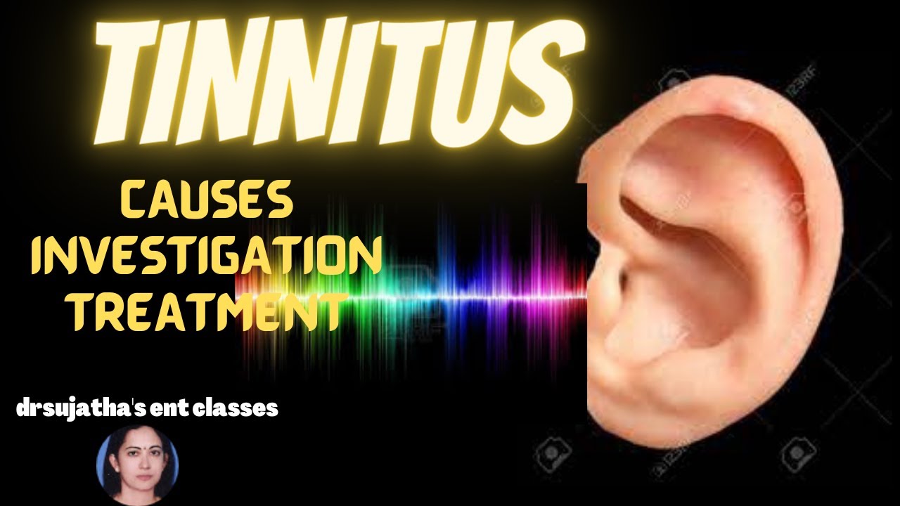 174.Tinnitus Causes/investigation and treatment  #tinnitus lecture  #ear #hearingloss