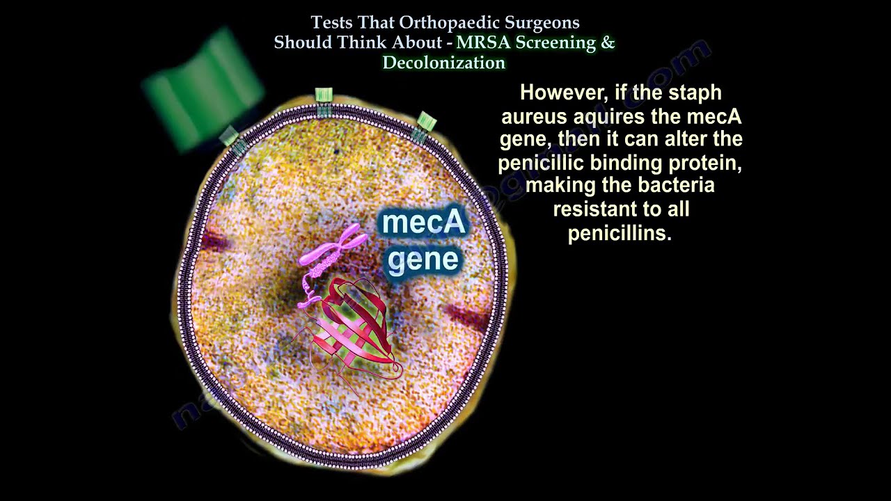 MRSA Carrier Screening and Decolonization Before Surgery
