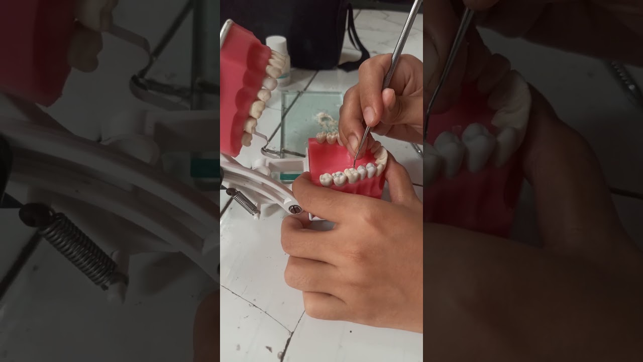 End Posting Day🦷|| #pedodontics #bds #dentist #dentalstudentlife