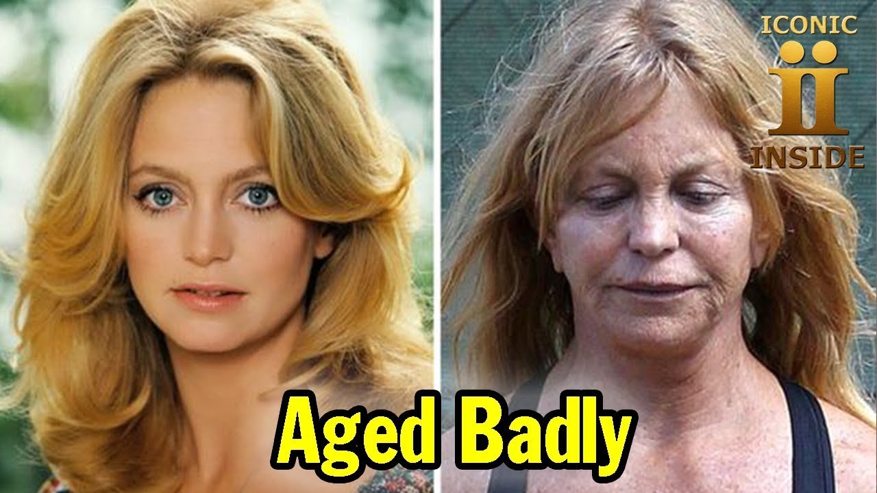 25 Celebrities Who Have Aged Badly