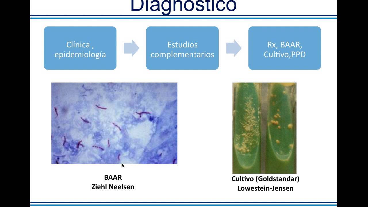 Patología  III Tuberculosis