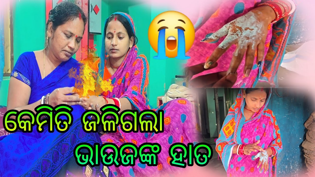 କେମିତି ଜଳିଗଲା ଭାଉଜଙ୍କ ହାତ 😭
