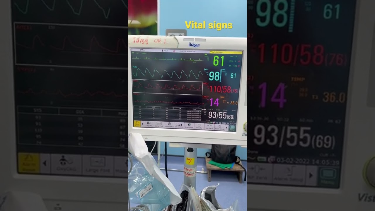 Monitoring during an anesthesia. The most important part during patient sleep. #anesthesia