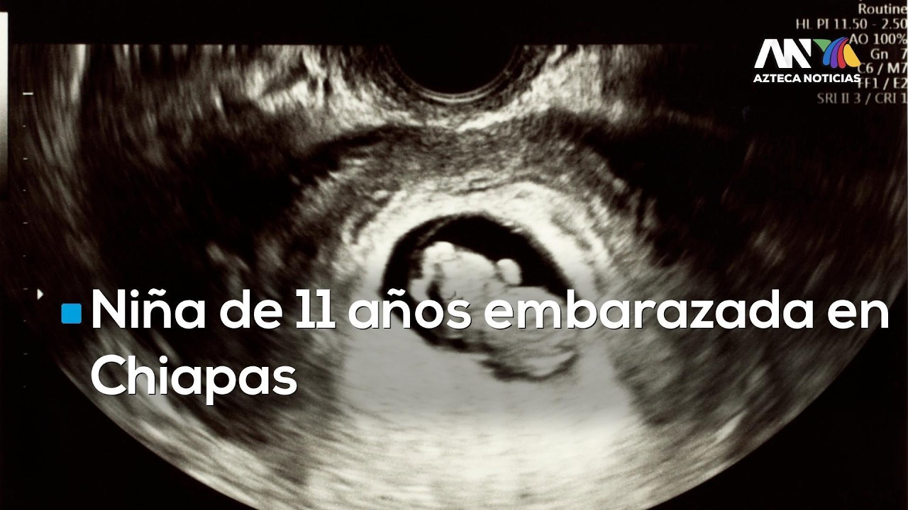 #AgendaMéxico | Niña de 11 años embarazada denuncia abuso en Chiapas