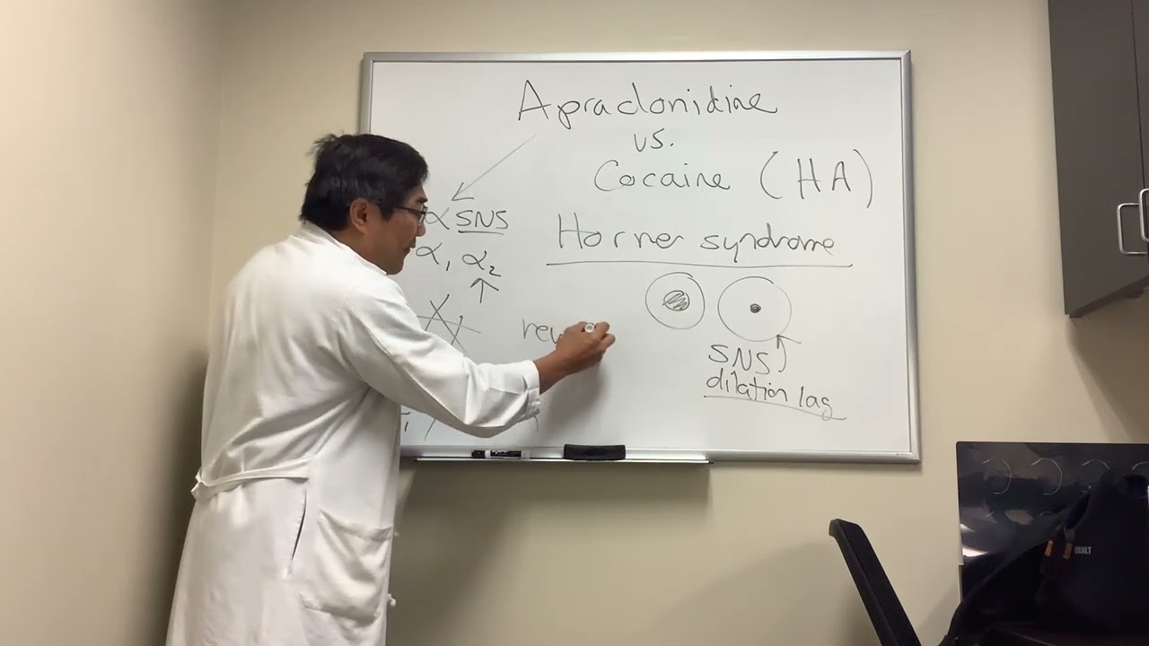 Apraclonidine versus Cocaine drop