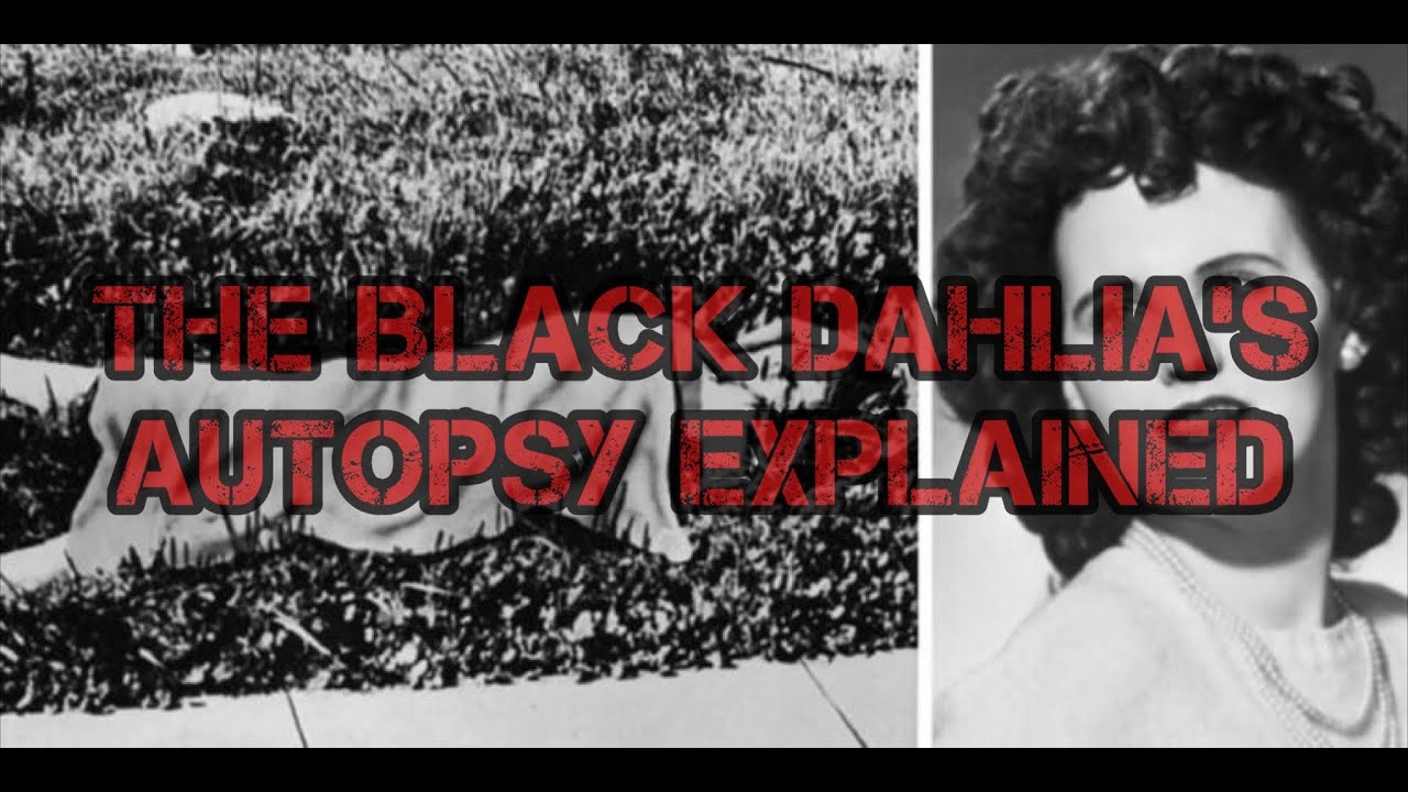Famous Autopsies- The Black Dahlia