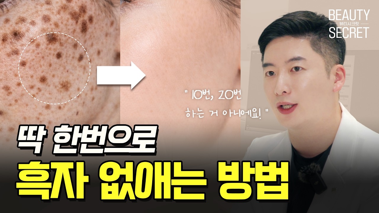 기미인 줄 알았는데 흑자였습니다 ! 치료가 전혀 다른 이유 l 부산리팟, 부산흑자