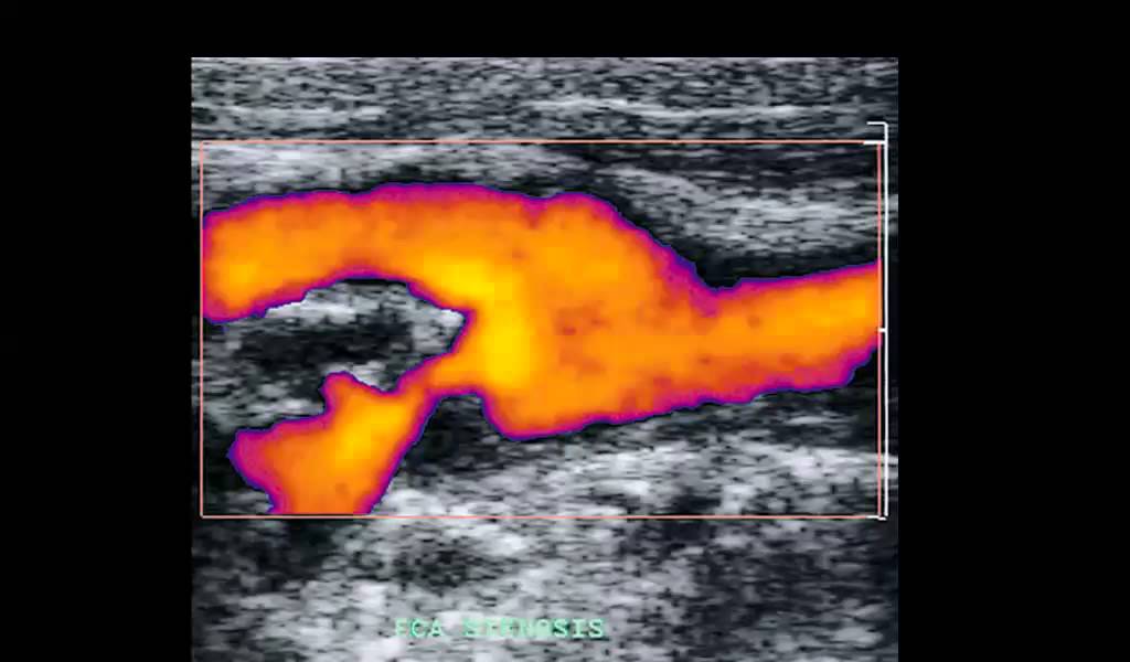 INTRO TO IMAGING MODALITES