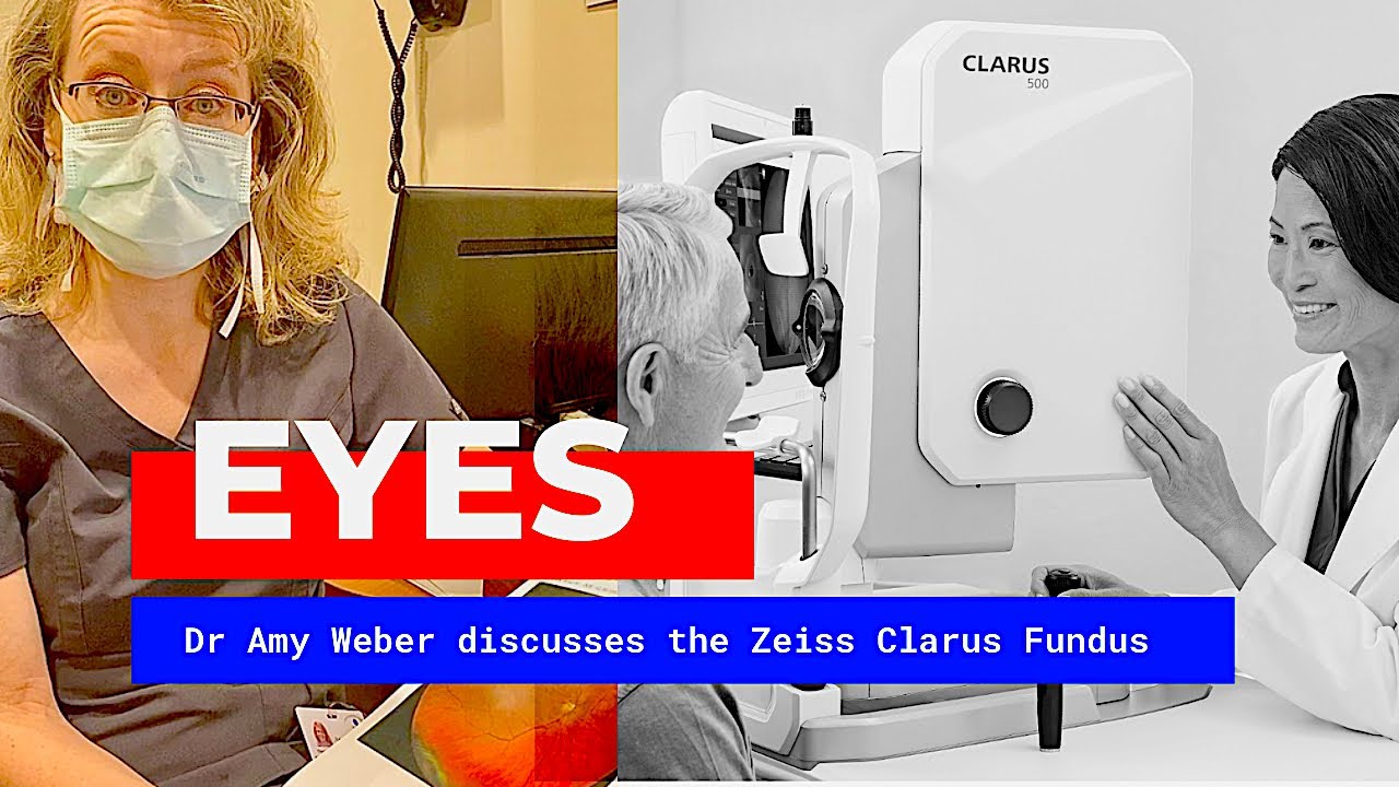 Eye doctors uses high resolution digital camera to avoid dilation