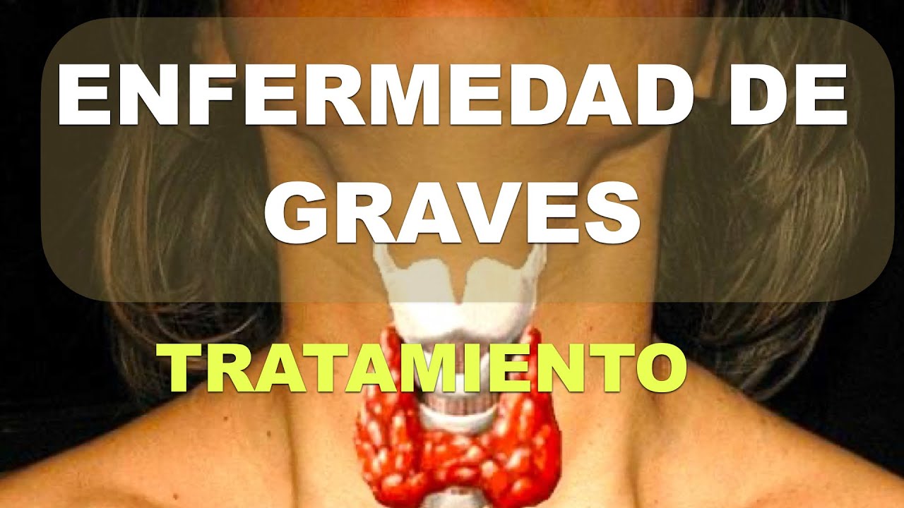 Enfermedad de Graves. Tratamiento