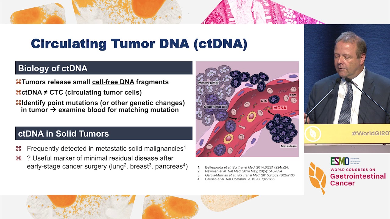 Can we refine the selection for adjuvant treatment in stage II colon cancer?
