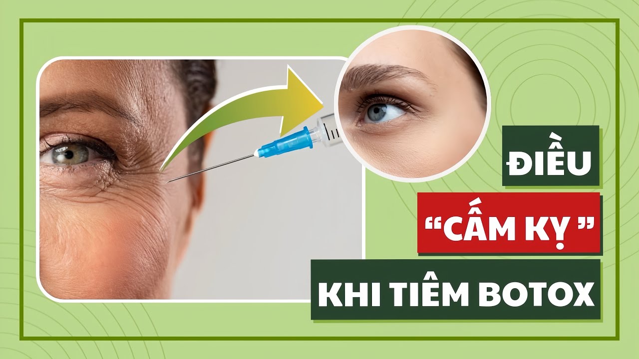 Tiêm Botox cần lưu ý gì?