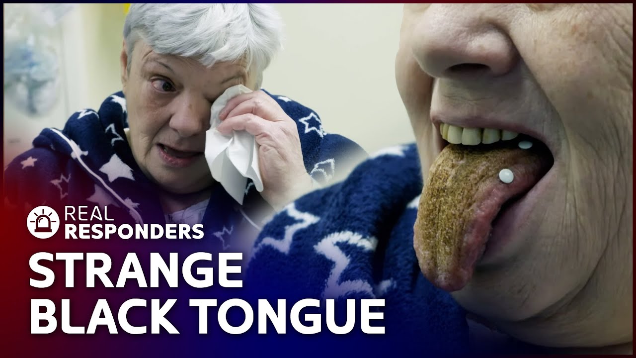 Doctors Stunned By Black Tongue Scare | Casualty 24/7