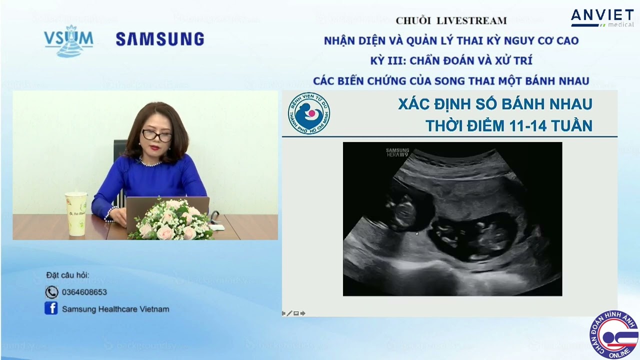 #3.1 Vai trò của siêu âm trong đánh giá song thai một bánh nhau - ThS. BS.  Hà Tố Nguyên