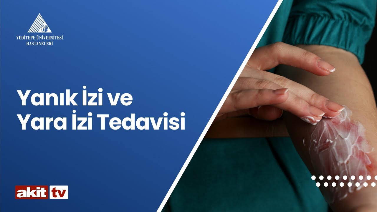 Yanık İzi ve Yara İzi Tedavisi