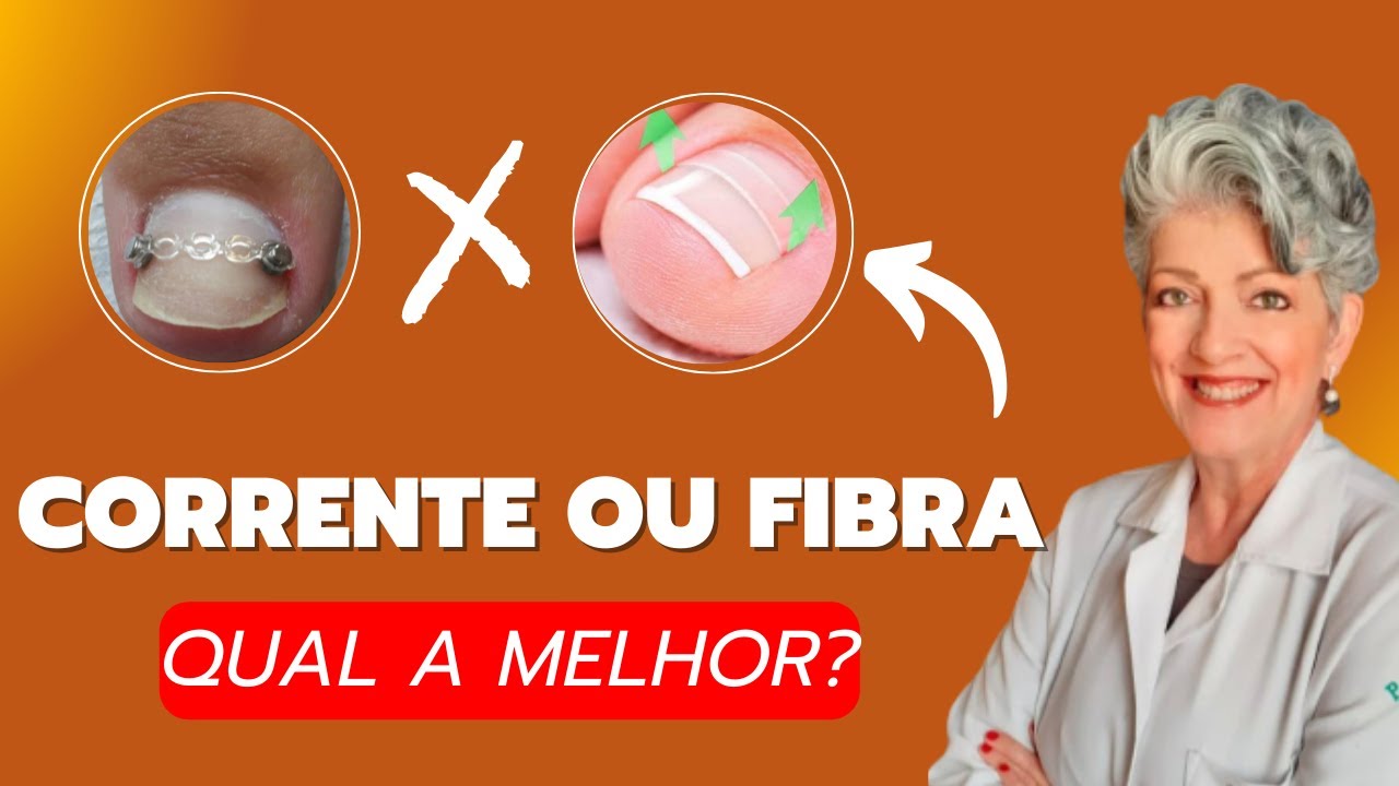 ÓRTESE FIBRA OU CORRENTE Qual a Melhor