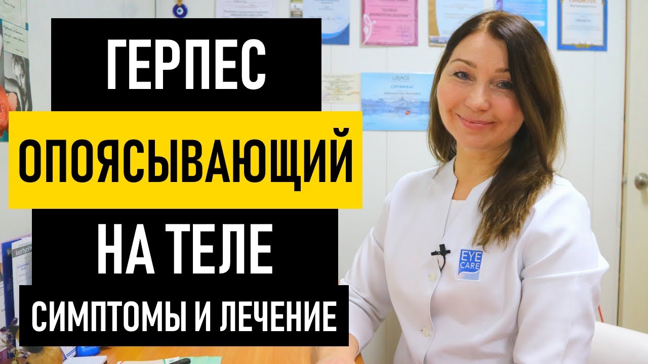 Опоясывающий герпес: симптомы и лечение. Чем и как лечить опоясывающий лишай на теле