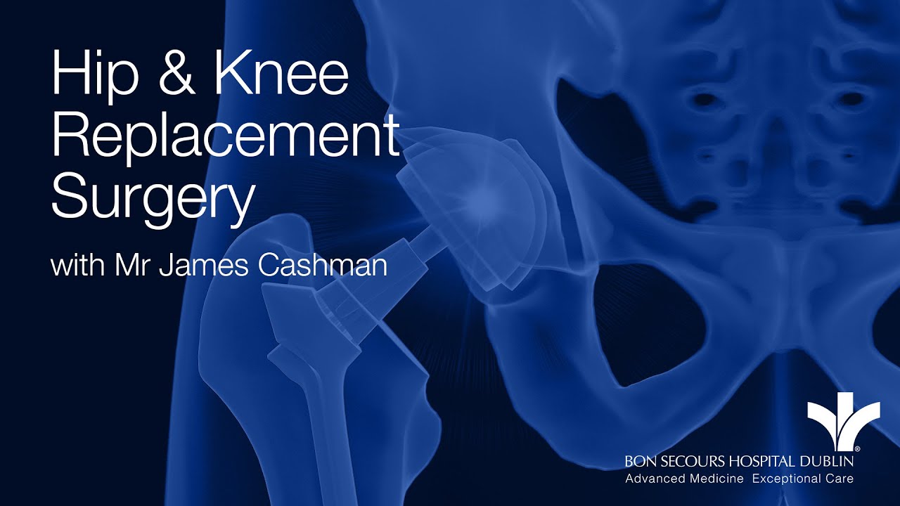 Hip and Knee Replacement Surgery with Mr James Cashman