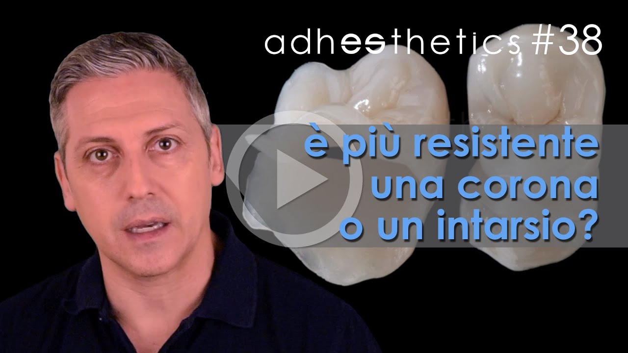 🇮🇹 È più resistente una corona o un intarsio?_corto#38 ITA_Adhesthetics Protocols
