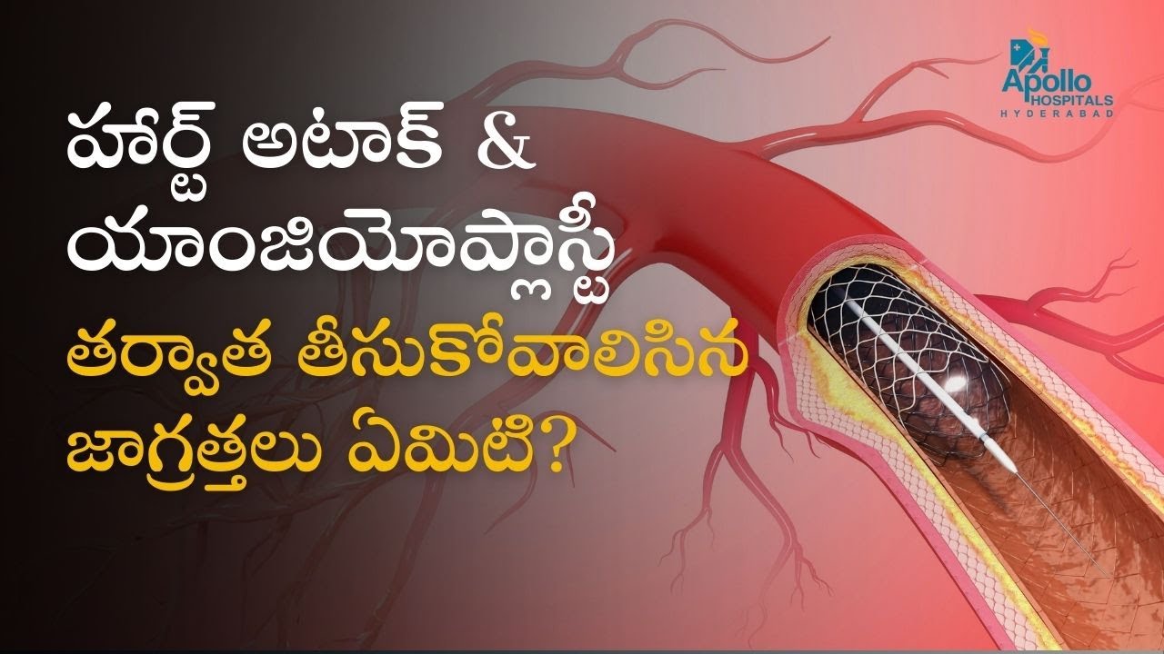 Life After Angioplasty: Heart Attack Care & Recovery | Dr Enosh Katta |Apollo Hospitals