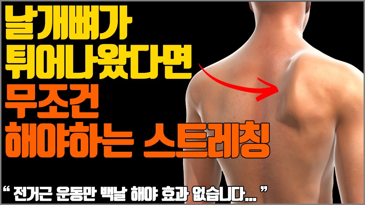 날개뼈가 튀어나왔다면 운동이 아니라 무조건 스트레칭이 우선입니다 [익상견갑 초간단 해결법]