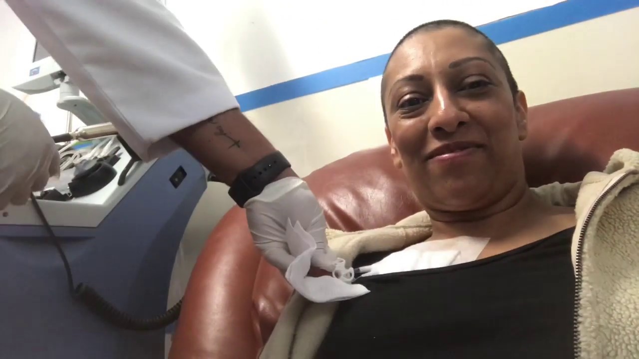 Day -2 Stem cell collection, the Apheresis process