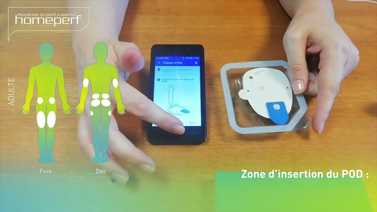 5 1 REMPLISSAGE ET POSE POD DASH POMPE OMNIPOD DASH E UNIVERSITÉ V1