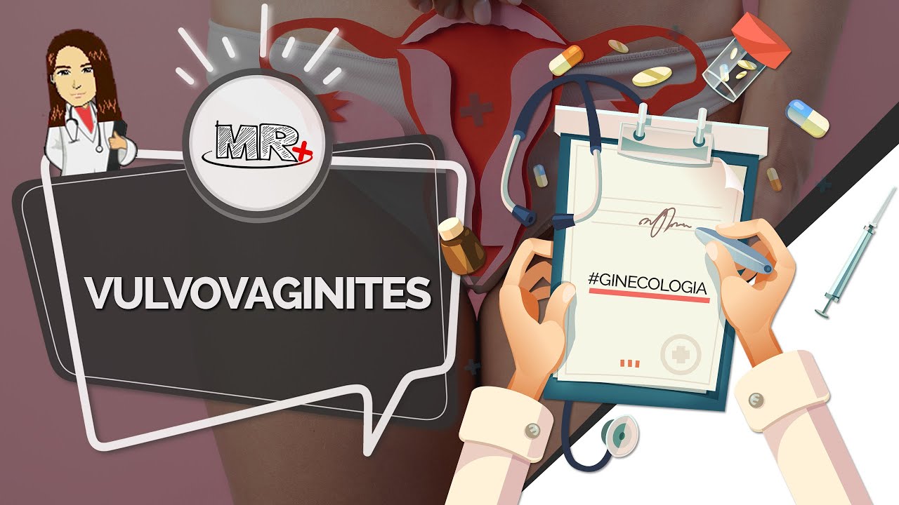 Vulvovaginites - Aula de revisão de Ginecologia do MR Plus