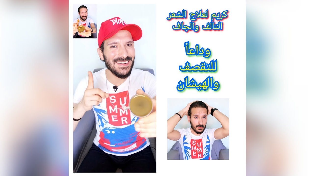 كريم طبيعي لعلاج تقصف الشعر والهيشان والشعر الجاف والتالف👌