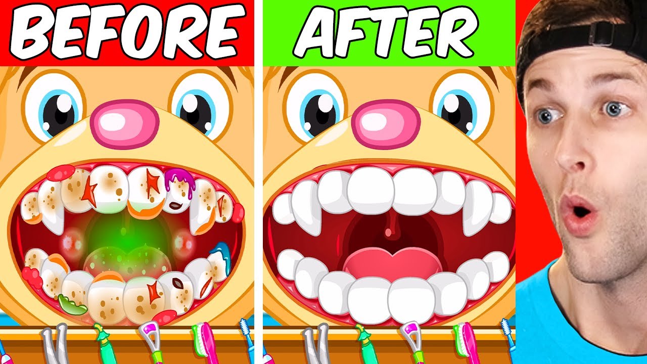 Cleaning The Most DISGUSTING TEETH In The WORLD!