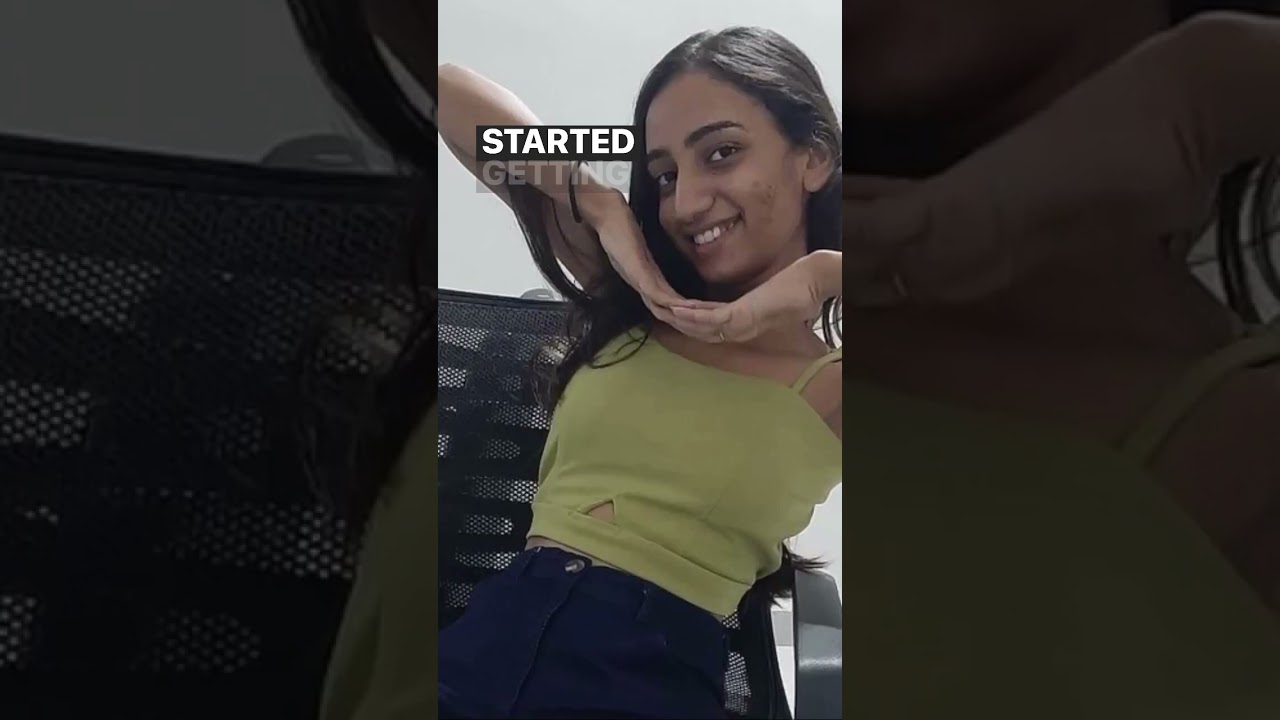 Sharing my acne story.