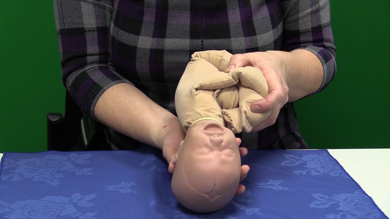 Механизм родов в затылочно-заднем положении – короткий поворот