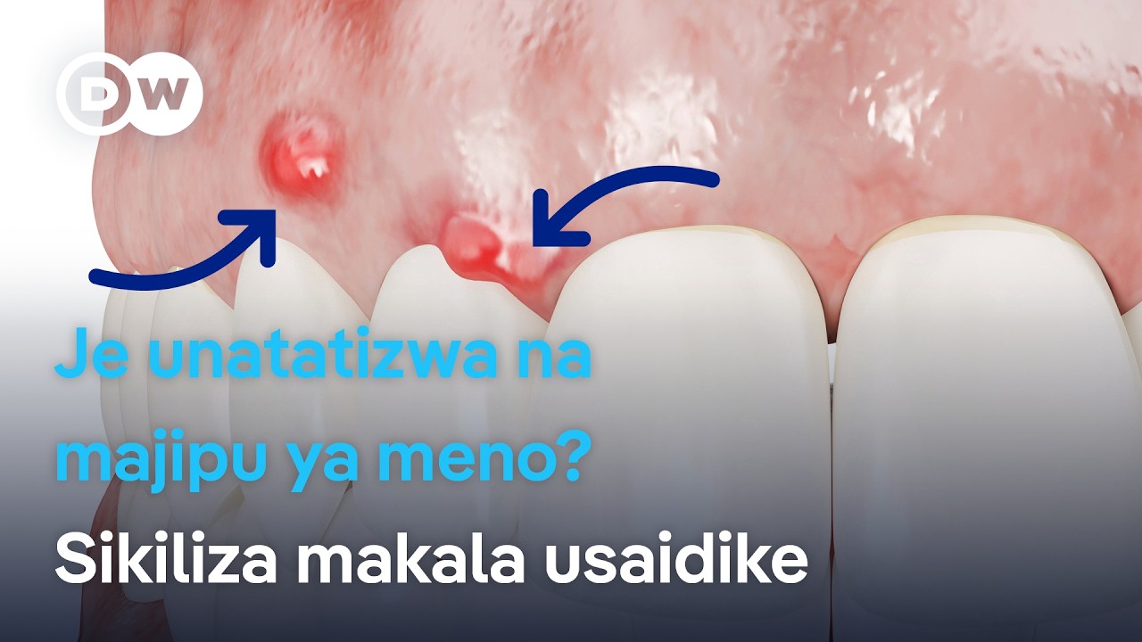 Afya Yako: Majipu ya jino husababishwa na nini na hutibiwa vipi? | DW Kiswahili