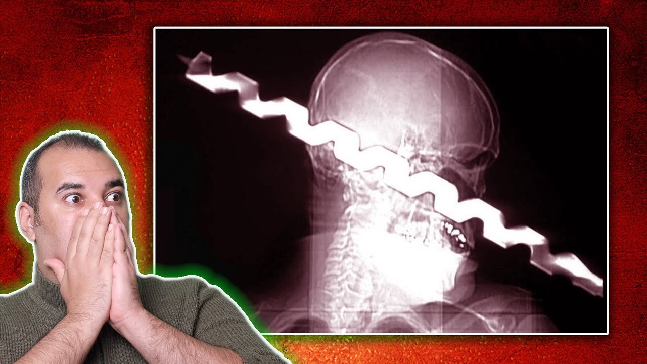 3 قصص اغرب من الخيال .. لكنها حقيقية 100% - الجزء الثاني 