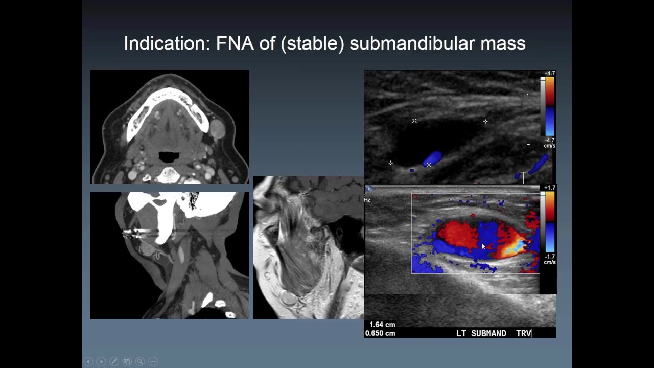 Dr. Kolokythas - Tips and Tricks in Body Imaging Procedures